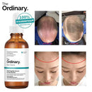 Suero Capilar Anti‑Caída The Ordinary - Multi‑Péptidos + Resultados en 15 días